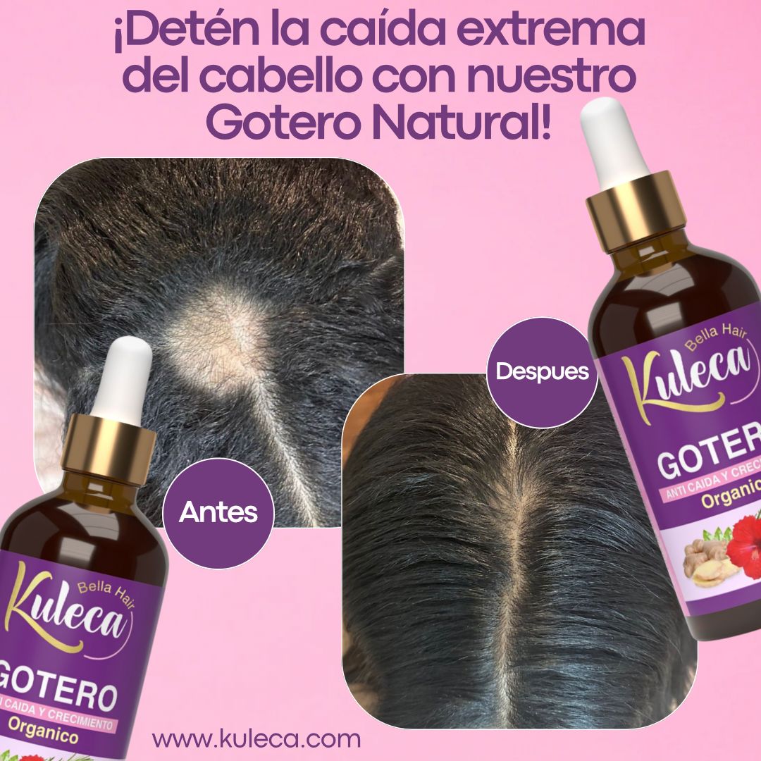 Gotero Anticaída y Crecimiento